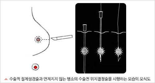 총조직검사 과정