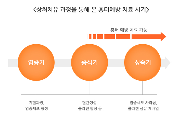 염증기:지혈과정, 염증세포 형성 → 증식기:혈관생성, 콜라겐 합성 등 → 성숙기:염증세포 사라짐, 콜라겐 섬유 재배열 / 염증기에서 성숙기로 갈수록 흉터예장치료가능하다.