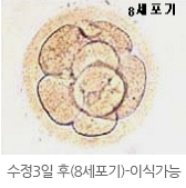 수정3일 후(8세포기)-이식가능