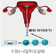 수정4~4일후(상실배)