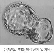 수정란의 부화(착상전에 일어남)