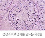 정상적으로 정자를 만드는 세정관